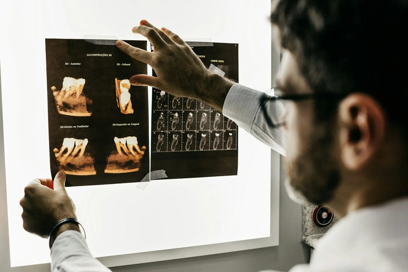 Odontólogo revisando radiografías en el negatoscopio