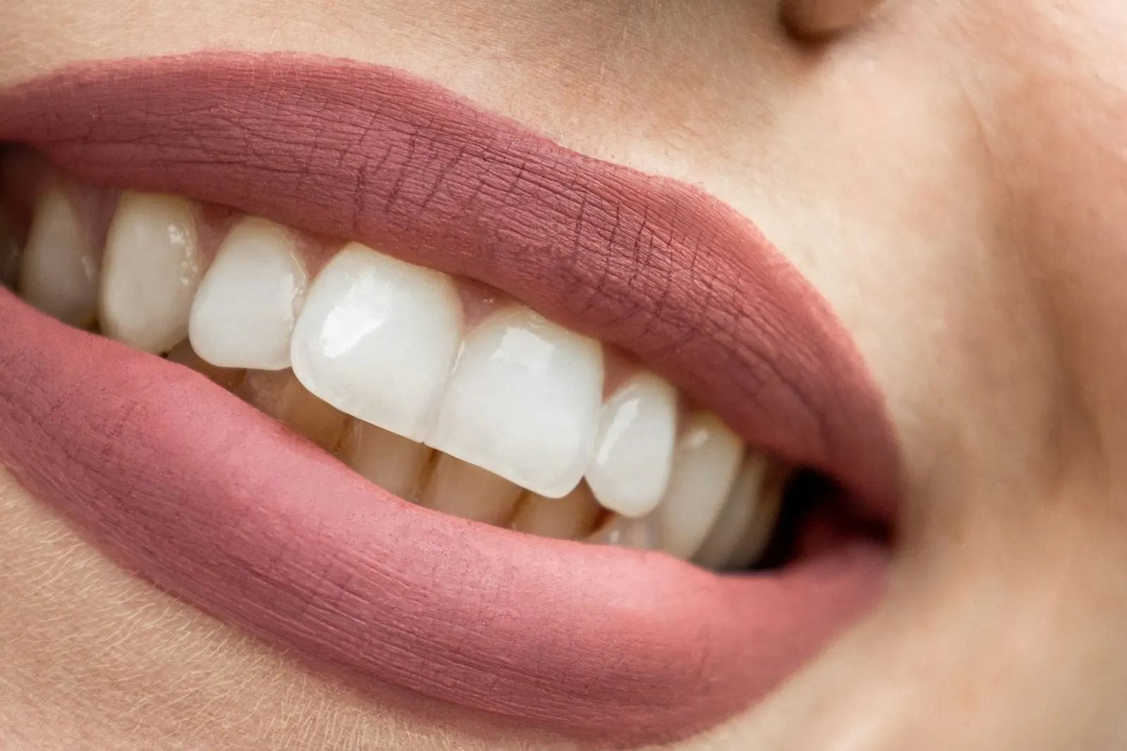 Primer plano de una sonrisa con los dientes cuidados